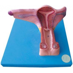 女性内生殖器官模型