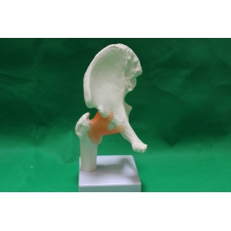 功能髋关节模型